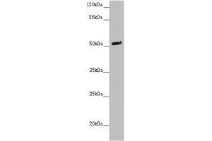 Western blot All lanes: NOXA1 antibody at 2 μg/mL + Mouse brain tissue Secondary Goat polyclonal to rabbit IgG at 1/10000 dilution Predicted band size: 51, 52, 46 kDa Observed band size: 51 kDa (NOXA1 抗体  (AA 150-313))