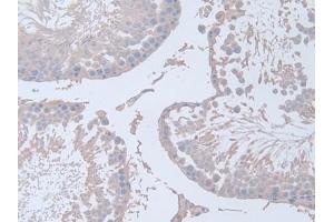Detection of IFNg in Rat Testis Tissue using Polyclonal Antibody to Interferon Gamma (IFNg) (Interferon gamma 抗体  (AA 23-156))