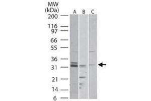 Western blot analysis of RTN4R in A) human, B) mouse and C) rat brain tissue lysate. (RTN4R 抗体  (AA 50-100))