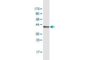 Western Blotting (WB) image for anti-Zinc Finger, C3HC-Type Containing 13 (ZCCHC13) (AA 1-166) antibody (ABIN949969)