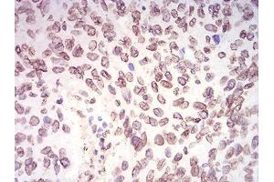 Immunohistochemistry (IHC) image for anti-Lamin B2 (LMNB2) (AA 401-600) antibody (ABIN5870700) (Lamin B2 抗体  (AA 401-600))