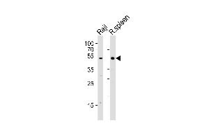 Western blot analysis of lysates from Raji cell line and rat spleen tissue lysate(from left to right), using Mouse Lyn Antibody (Center) (ABIN6243396 and ABIN6577552). (LYN 抗体  (AA 229-263))