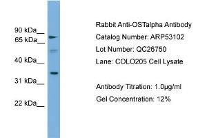WB Suggested Anti-OSTalpha  Antibody Titration: 0. (OST alpha 抗体  (Middle Region))