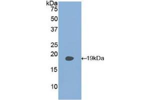Western blot analysis of recombinant Human PLAA. (PLAA 抗体  (AA 162-312))