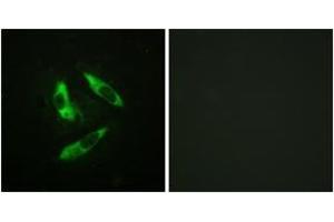 Immunofluorescence analysis of HeLa cells, using Rabphilin 3A (Phospho-Ser237) Antibody. (RPH3A 抗体  (pSer237))