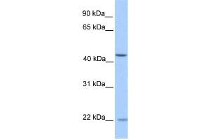 WB Suggested Anti-ZNF485 Antibody Titration:  0. (ZNF485 抗体  (N-Term))