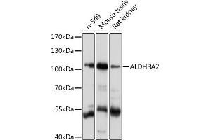 Western blot analysis of extracts of various cell lines, using  Rabbit pAb  at 1:1000 dilution. (ALDH3A2 抗体  (AA 250-320))