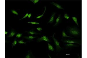 Immunofluorescence (IF) image for anti-Inhibitor of DNA Binding 1, Dominant Negative Helix-Loop-Helix Protein (ID1) (AA 47-155) antibody (ABIN516791)