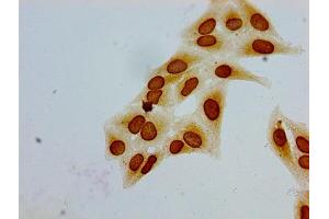 Immunocytochemistry analysis of Hela cells using ABIN7139188 at dilution of 1:100 (HIST1H1E 抗体  (acLys51))