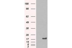 HEK293T cells were transfected with the pCMV6-ENTRY control (Left lane) or pCMV6-ENTRY CRYAB (Right lane) cDNA for 48 hrs and lysed. (CRYAB 抗体)