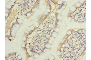 Immunohistochemistry of paraffin-embedded human small intestine tissue using ABIN7158166 at dilution of 1:100 (LRRC39 抗体  (AA 1-335))