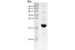 Western Blotting (WB) image for Tripartite Motif Containing 24 (TRIM24) (AA 862-980) protein (His tag,DYKDDDDK Tag) (ABIN2669633)