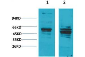 Western Blot (WB) analysis of 1) Mouse Brain Tissue, 2) Rat Brain Tissue with Bombesin Receptor 2 Rabbit Polyclonal Antibody diluted at 1:2000. (Bombesin Receptor 2 抗体)