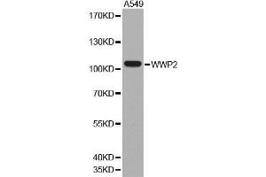 Western blot analysis of extracts of A549 cell line, using WWP2 antibody. (WWP2 抗体  (AA 151-400))