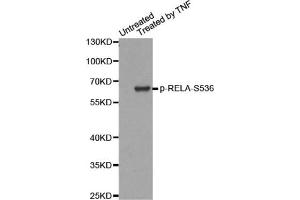 Western blot analysis of extracts from HepG2 cells, using Phospho-RELA-S536 antibody. (NF-kB p65 抗体  (pSer536))