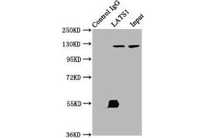 Immunoprecipitating LATS1 in K562 whole cell lysate Lane 1: Rabbit control IgG (1 μg) instead of ABIN7169059 in K562 whole cell lysate. (LATS1 抗体  (AA 1-280))