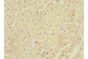 Immunohistochemistry of paraffin-embedded human heart tissue using ABIN7152439 at dilution of 1:100