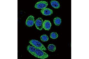 Immunofluorescence (IF) image for anti-Actin, alpha 1, Skeletal Muscle (ACTA1) (AA 346-375), (C-Term) antibody (ABIN658563)