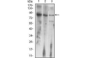 Western blot analysis using LHCGR mouse mAb against HepG2 (1), Jurkat (2), and SMMC-7721 (3) cell lysate. (LHCGR 抗体)