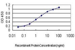 Detection limit for recombinant GST tagged ERN1 is approximately 0. (ERN1 抗体  (AA 401-500))