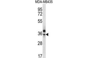 Western Blotting (WB) image for anti-Olfactory Receptor, Family 51, Subfamily Q, Member 1 (OR51Q1) antibody (ABIN2996658) (OR51Q1 抗体)