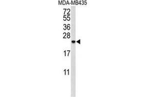 Western blot analysis of IL10 (arrow) in MDA-MB435 cell line lysates (35ug/lane) using Interleukin-10 / IL10 (IL-10 抗体  (Middle Region))