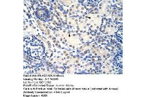 Rabbit Anti-RNASEH2A Antibody  Paraffin Embedded Tissue: Human Kidney Cellular Data: Epithelial cells of renal tubule Antibody Concentration: 4. (RNASEH2A 抗体  (C-Term))
