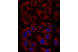 Confocal immunofluorescence analysis of U2OS cells using B Polyclonal Antibody (ABIN6131419, ABIN6137118, ABIN6137119 and ABIN6224820) at dilution of 1:100. (ARL8B 抗体  (AA 127-186))