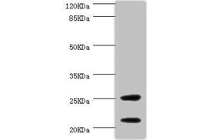 Western blot All lanes: CSRP3 antibody at 1 μg/mL + Mouse skeletal muscle tissue Secondary Goat polyclonal to rabbit IgG at 1/10000 dilution Predicted band size: 21 kDa Observed band size: 21, 25 kDa (CSRP3 抗体  (AA 1-194))