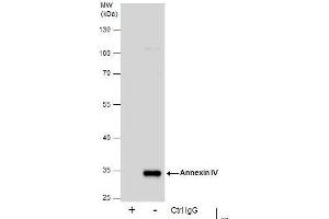 IP Image Immunoprecipitation of Annexin IV protein from HepG2 whole cell extracts using 5 μg of Annexin IV antibody, Western blot analysis was performed using Annexin IV antibody, EasyBlot anti-Rabbit IgG  was used as a secondary reagent. (Annexin IV 抗体)