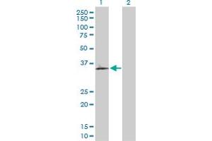 Western Blot analysis of OLR1 expression in transfected 293T cell line by OLR1 MaxPab polyclonal antibody. (OLR1 抗体  (AA 1-273))