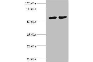 Western blot All lanes: CYP4F12 antibody at 6 μg/mL Lane 1: Mouse small intestine tissue Lane 2: Rat liver tissue Secondary Goat polyclonal to rabbit IgG at 1/10000 dilution Predicted band size: 61, 12 kDa Observed band size: 61 kDa (CYP4F12 抗体  (AA 265-524))