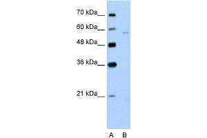 WB Suggested Anti-SLC22A7 Antibody Titration:  5. (SLC22A7 抗体  (N-Term))