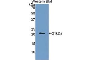 WB of Protein Standard: different control antibodies against Highly purified E. (ORM1 ELISA 试剂盒)