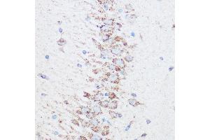 Immunohistochemistry of paraffin-embedded rat brain using SIRT4 Rabbit pAb (ABIN6129330, ABIN6147796, ABIN6147797 and ABIN6223494) at dilution of 1:100 (40x lens). (SIRT4 抗体  (AA 29-260))