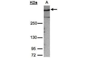 WB Image Sample (30μg whole cell lysate) A:HeLa S3, 5% SDS PAGE antibody diluted at 1:1000 (AKAP12 抗体  (C-Term))