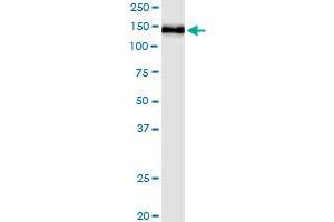 Immunoprecipitation of PHC1 transfected lysate using anti-PHC1 MaxPab rabbit polyclonal antibody and Protein A Magnetic Bead , and immunoblotted with PHC1 purified MaxPab mouse polyclonal antibody (B01P) . (PHC1 抗体  (AA 1-957))
