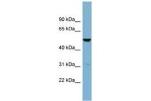 Image no. 1 for anti-Serine Dehydratase-Like (SDSL) (C-Term) antibody (ABIN6743388) (SDSL 抗体  (C-Term))