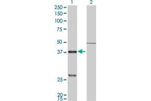 Western Blotting (WB) image for anti-Cathepsin K (CTSK) (AA 220-329) antibody (ABIN514786)