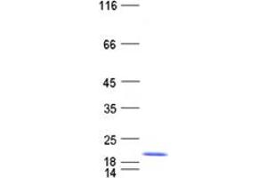 Validation with Western Blot