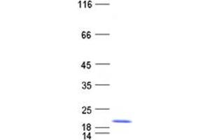 Validation with Western Blot (S100A9 Protein (His tag))