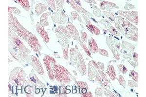 Detection of MYLK3 in Human Heart Tissue using Polyclonal Antibody to Myosin Light Chain Kinase 3 (MYLK3)