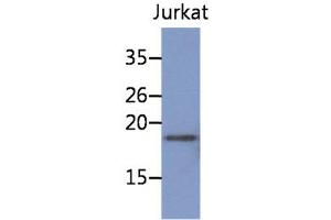 The cell lysate of Jurkat (30ug) were resolved by SDS-PAGE, transferred to PVDF membrane and probed with anti-human NBL1 antibody (1:1000). (NBL1 抗体)