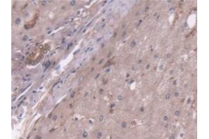 Immunohistochemistry (IHC) image for anti-Pyruvate Carboxylase (PC) (AA 36-486) antibody (ABIN7441475)