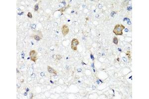 Immunohistochemistry (Paraffin-embedded Sections) (IHC (p)) image for anti-Retinol Binding Protein 2, Cellular (RBP2) antibody (ABIN7262617)