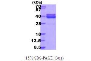 SDS-PAGE (SDS) image for 5'-Nucleotidase, Cytosolic III-Like (NT5C3L) (AA 1-300) protein (His tag) (ABIN5853976)
