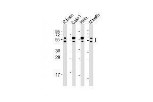 All lanes : Anti-CDKL3 Antibody (N-Term) at 1:2000 dilution Lane 1: rat brain lysates Lane 2: Caki-1 whole cell lysates Lane 3: Hela whole cell lysates Lane 4: mouse testis lysates Lysates/proteins at 20 μg per lane. (CDKL3 抗体  (AA 2-34))