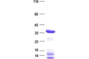 Western Blotting (WB) image for Cyclin-Dependent Kinase-Like 4 (CDKL4) protein (His tag) (ABIN2713873)