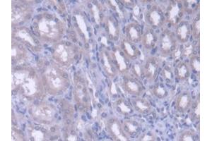 DAB staining on IHC-P; Samples: Rat Kidney Tissue (FARS2 抗体  (AA 1-472))