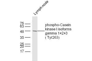 Mouse lymph node lysates probed with Casein kinase I isoforms gamma 1+2+3 (Tyr263) Polyclonal Antibody, unconjugated  at 1:300 overnight at 4°C followed by a conjugated secondary antibody at 1:10000 for 60 minutes at 37°C. (CSNK1G1, CSNK1G2, CSNK1G3 (pTyr263) 抗体)